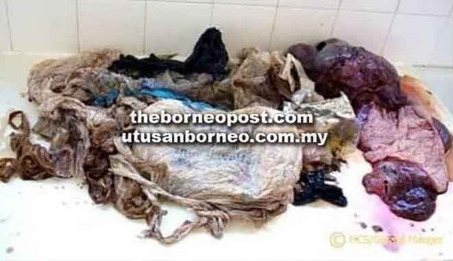  Bungkusan plastik yang ditemui dalam perut ikan lumba-lumba dan dikenal pasti sebagai salah satu faktor yang membunuhnya. 