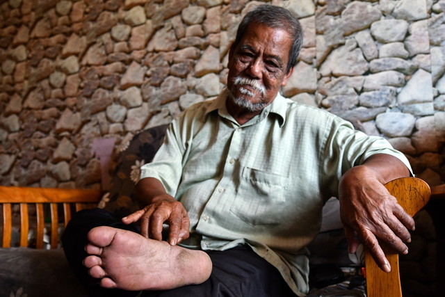 Othman menunjukkan kesan kakinya terpijak jerangkap samar yang dipasang pengganas komunis sehingga menyebabkan tulang di tapak kaki kanannya hancur semasa ditemui di kediamannya di Seberang Takir. - Gambar BERNAMA