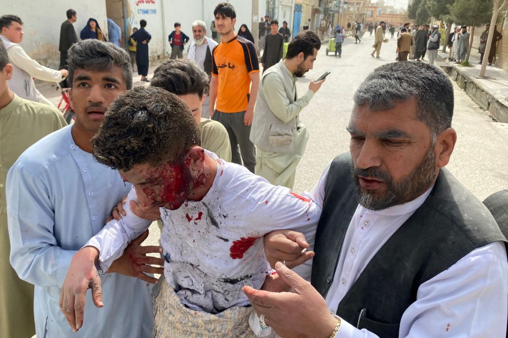 Seorang lelaki cedera (tengah) dibantu oleh orang awam yang berada berhampiran lokasi letupan bom semasa acara memperingati media di bandar Mazar-i-Sharif, kelmarin. — Gambar AFP