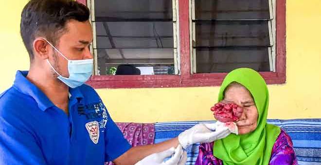 KASIH ANAK: Mohamad (kiri) mencuci luka di bahagian mata kanan Che Mariam yang menderita akibat kanser mata sejak setahun lalu ketika ditemui pemberita di rumahnya di Kampung Baru Pantai Mek Mas, di Kota Bahru semalam. — Gambar Bernama