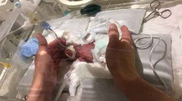 BAYI AJAIB: Gambar serahan tanpa tarikh ini yang dikeluarkan oleh Hospital Universiti Keio                 di Jepun pada Rabu menunjukkan seorang bayi berusia lima hari, seberat 268 gram pada waktu lahir, di hospital tersebut di Tokyo. — Gambar AFP